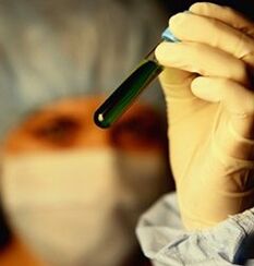 kako se testirati na parazite