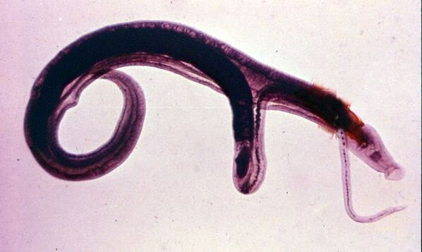Šistosomi so eni najpogostejših in najnevarnejših parazitov